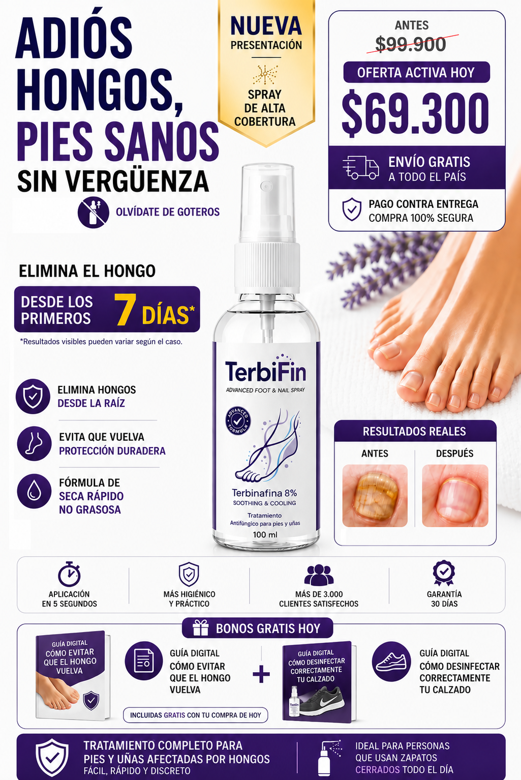 Terbifin