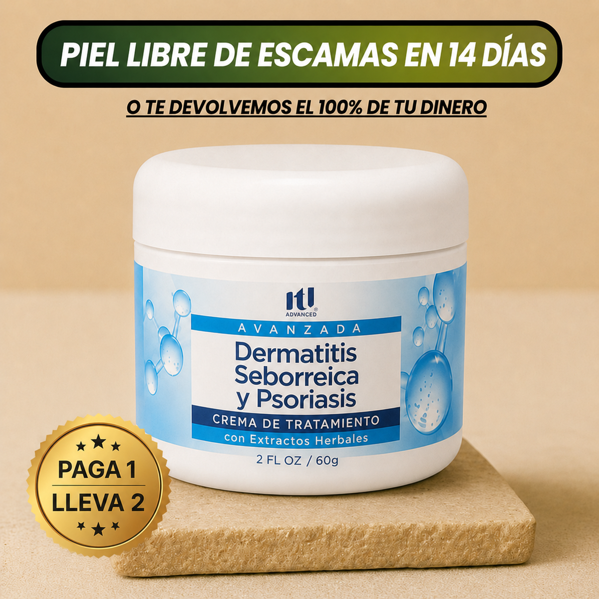 Seborrheic Dermatitis & Psoriasis